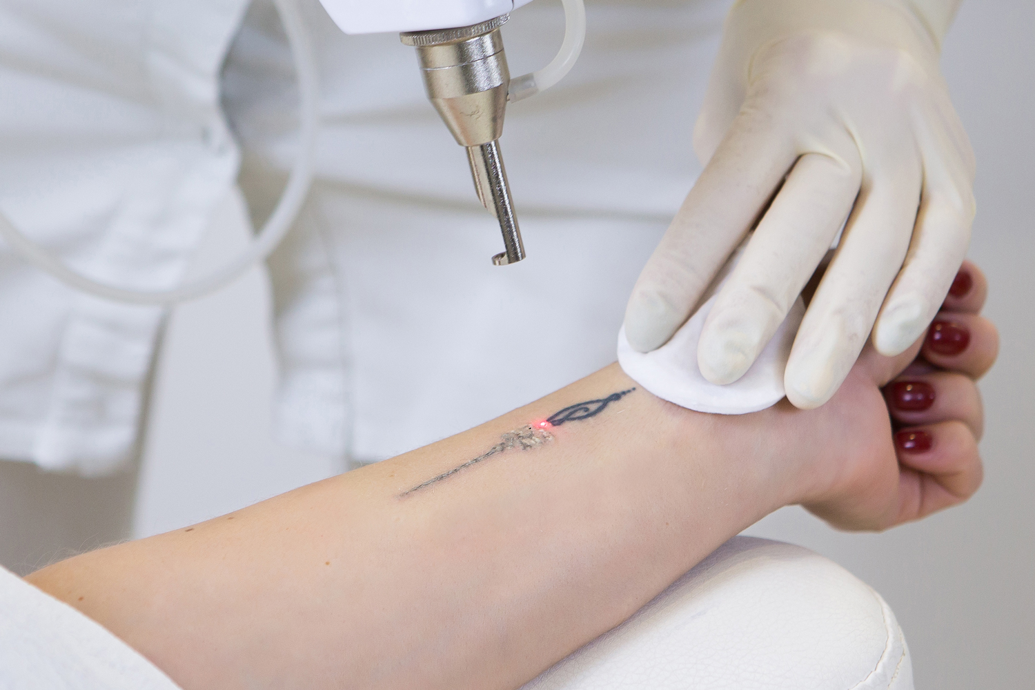 Laser tattoo removal is a process  SWIPE  Everyones experience and  results can vary depending on factors such as size colour depth   Instagram